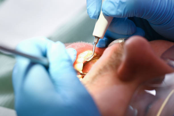Best Same-Day Emergency Dental Services in Marion, WI