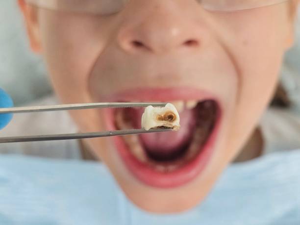 Best Same-Day Emergency Dental Services in Marion, WI